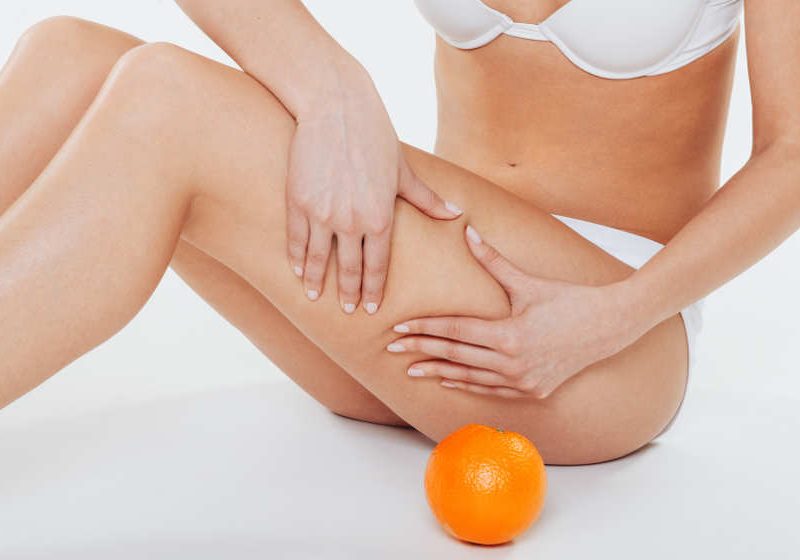 Velashape