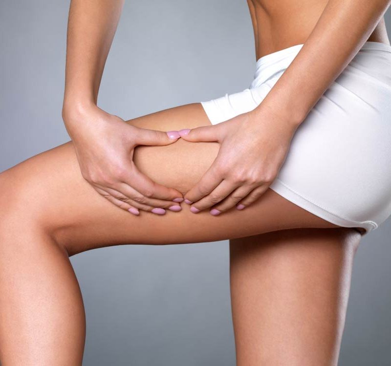 que-tipo-celulitis-tienes