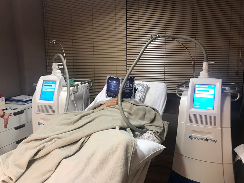 Coolsculpting-Eliminar-Grasa-Corporal