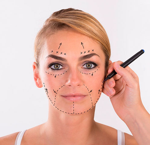 hilos faciales zaragoza