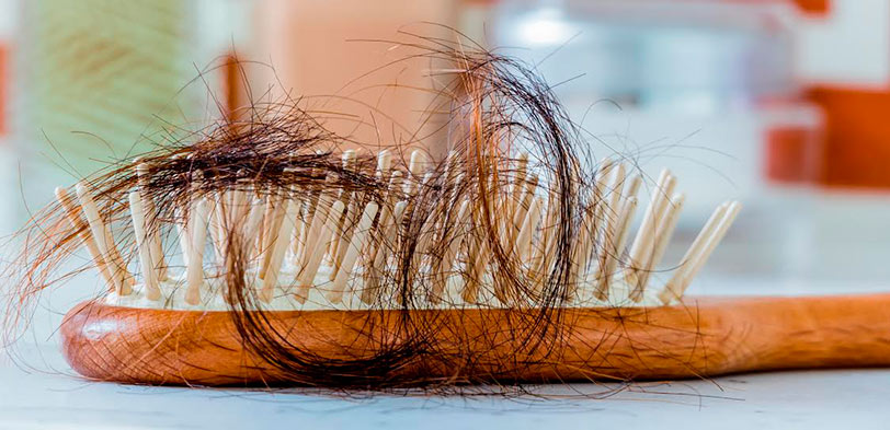 Caida del pelo